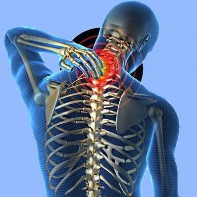 dhimbje në qafë me osteokondrozë të qafës së mitrës